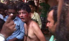 Bị cắt phăng 'của quý' vì cố hiếp dâm cô gái