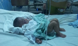 Cháu bé bị bỏng đang điều trị tại bệnh viện.