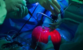 Tử cung người mẹ được tạm lấy ra, bơm căng, chiếu sáng, trong khi các bác sĩ dùng dụng cụ nội soi để gây mê và phẫu thuật cho em bé bên trong - Ảnh do nhóm nghiên cứu cung cấp.