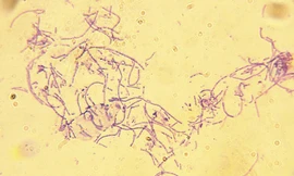 Vi khuẩn bệnh than có hình que dài. Ảnh: Live Science.