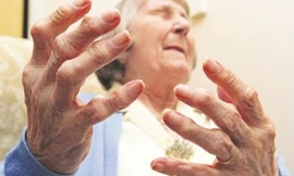 Đã có thuốc Đông y thế hệ 2 hạn chế tái phát viêm khớp, thoái hóa khớp