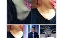 MC Minh Tiệp bị tố bạo hành em vợ: Cơ quan chức năng, thầy giáo nói gì