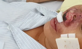 Cảnh báo bệnh truyền nhiễm nguy hiểm bùng phát