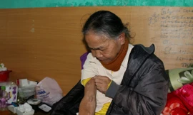 Sau những lần lọc máu, cơ thể bà Minh ngày càng rệu rã, chân tay sưng vù, nổi hạch, thường xuyên bị cơn đau buốt hành hạ