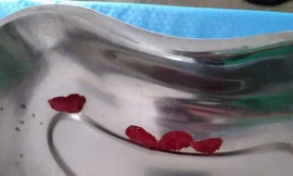 Bác sỹ ‘bắt’ 4 con sán lá gan trong dạ dày một phụ nữ