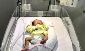 Cứu sống bé sinh non 28 tuần tuổi bị hoại tử dạ dày hiếm gặp