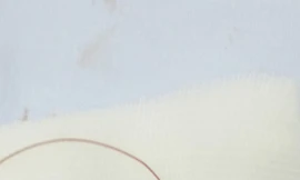 Tổn thương thị lực tới 99% vì bị lưỡi câu móc trúng mắt khi đi câu cá