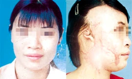 Tạt axít người dưng vì nghe 'thầy' phán