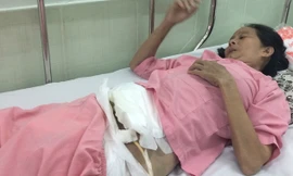 Bà Lợi khi còn điều trị tại khoa hồi sức - phẫu thuật tim, Bệnh viện Chợ Rẫy TPHCM. Ảnh: Quốc Ngọc.