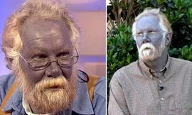 Bí ẩn về tộc người kì lạ có da màu xanh