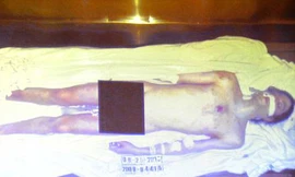 Tòa công bố ảnh thi thể khỏa thân của M.Jackson