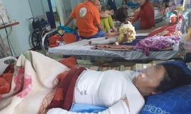 Chị T. bị phỏng nặng đang được điều trị tại bệnh viện 