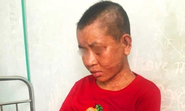 Chị Y Nhiêu vẫn đang tiếp tục điều trị các thương tích