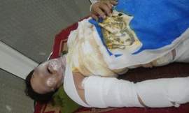 Bà Huyền đang được cấp cứu ở bệnh viện