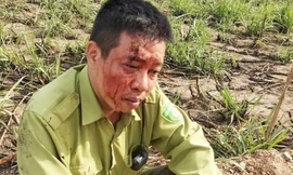 Anh Nhật bị ném gậy tre trúng đầy gây thương tích