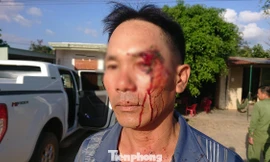 Ông Hôm bị đánh trọng thương ngay sau khi cung cấp thông tin cho báo chí