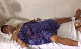 Bệnh nhân Tít cấp cứu tại bệnh viện do bị ong tấn công *ảnh: ĐK