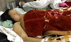 Bà Hồng kinh hãi khi nhắc lại chuyện mọi người bị bắn .Ảnh Duy Chiến