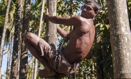 Người đàn ông có 'đuôi' dài 36 cm, leo trèo như khỉ