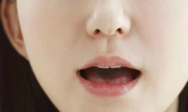 Ảnh minh họa: Wisegeek.com.