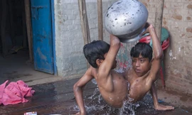 Cuộc sống của cặp sinh đôi liền thân