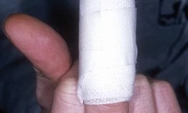 Kiện đòi bồi thường 2 triệu tỷ tỷ tỷ USD vì bị chó cắn