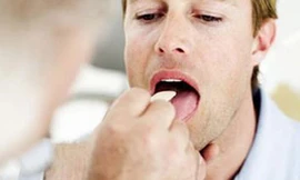 Sắp có kít phát hiện sớm ung thư vòm họng