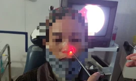 Vắt chui vào sống nhiều ngày trong mũi người phụ nữ ở Quảng Bình 