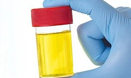 Bộ trưởng Ấn Độ muốn gom góp nước tiểu trên cả nước