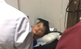 Bé N. bị chó cắn đã tử vong sau nhiều ngày điều trị.