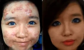Sốc với nữ sinh makeup mặt mụn trở thành hotgirl