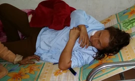 Một phụ nữ bị chồng cũ chém 11 nhát dao khắp người