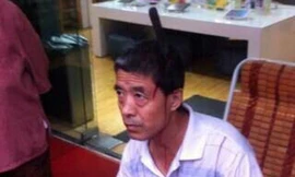 Hy hữu dao 'từ trên trời' cắm thẳng vào đầu