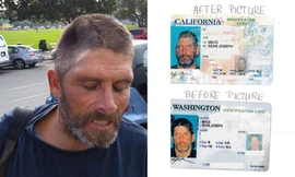 Hộp sọ của Sean chấn thương nghiêm trọng sau tai nạn hy hữu trong công viên. 