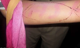 Cô gái khắc hình cá voi xanh lên tay để tham gia làm nhiệm vụ. Ảnh: Jodhpur Police. 