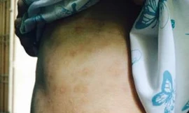 Thiếu nữ 17 tuổi tố cha mẹ nuôi bạo hành, cưỡng bức