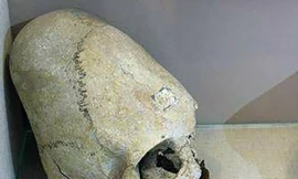 Các chiến binh Sarmatia cổ đại đều có phần hộp sọ dài khác thường. 