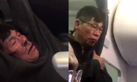 Hình ảnh hành khách người Mỹ gốc Việt David Dao bị nhân viên an ninh lôi kéo thô bạo ra khỏi máy bay đang khiến cộng đồng mạng bức xúc.