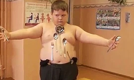 Cậu bé có khả năng hút đồ vật sau tai nạn điện giật