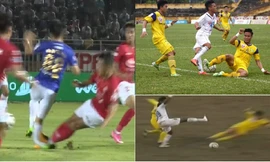 Những ca gãy chân kinh hoàng trong làng bóng đá Việt 