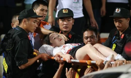 Lực lượng an ninh và bác sĩ chuyển nữ CĐV bị thương vì pháo sáng đi bệnh viện. Ảnh: Vnexpress