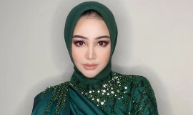 Hoa hậu đẹp nhất Thế giới bị chê xuống sắc 