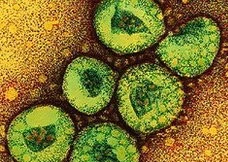 Hướng dẫn chẩn đoán, điều trị virus corona mới