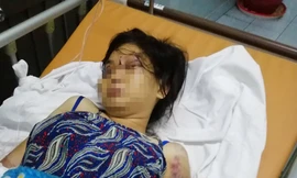 Truy bắt kẻ liên quan vụ đánh phụ nữ đến sẩy thai