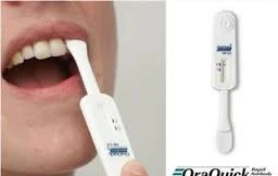 Lần đầu tiên có bộ dụng cụ xét nghiệm HIV tại nhà