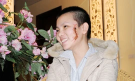 Cô gái bị xăm rết lên mặt muốn làm việc ở bệnh viện