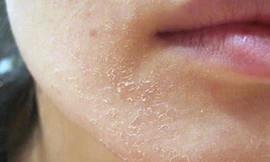 Ảnh minh họa: Internet