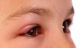 Ảnh minh họa: Internet