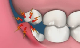 Ảnh minh họa: Internet