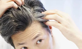 Ảnh minh họa: Internet